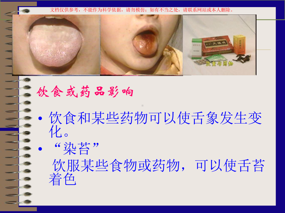 舌诊医学知识讲座培训课件.ppt_第2页