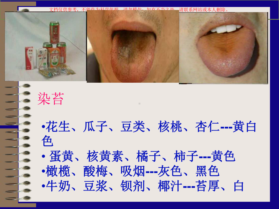 舌诊医学知识讲座培训课件.ppt_第3页