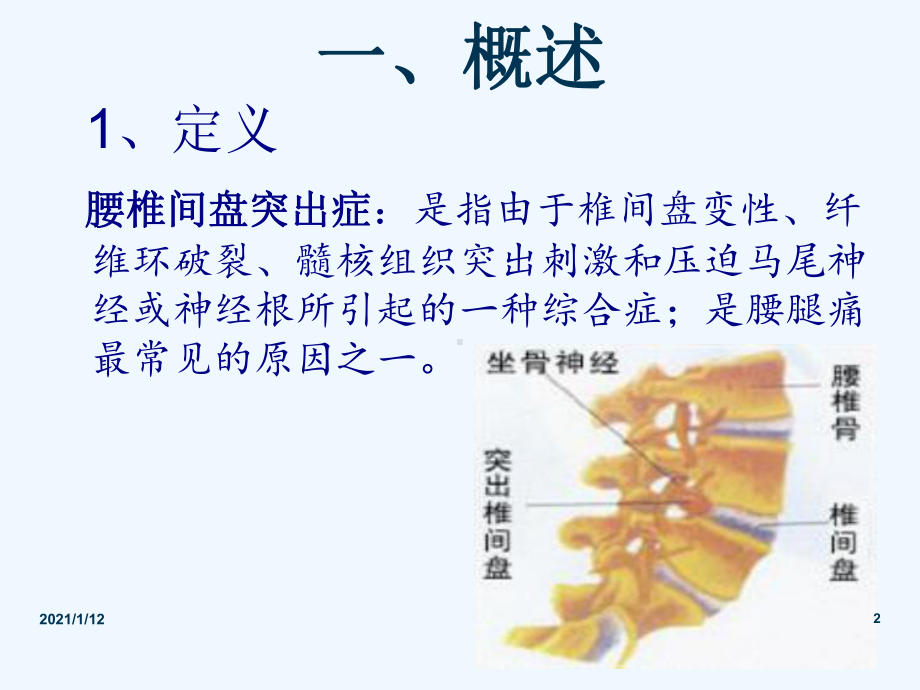 腰腿痛护理查房课件.ppt_第2页