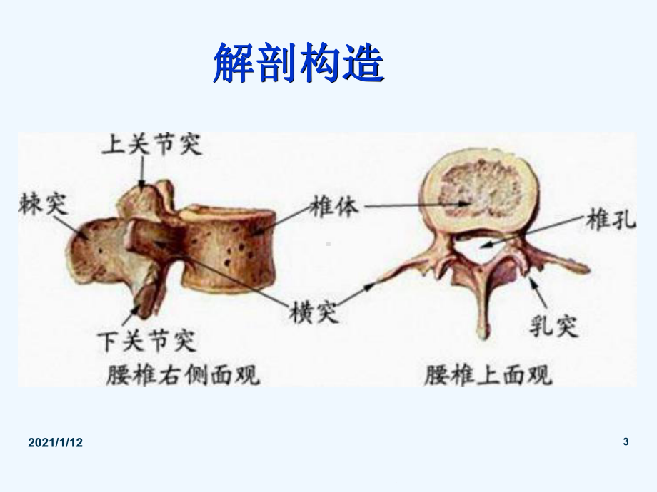 腰腿痛护理查房课件.ppt_第3页