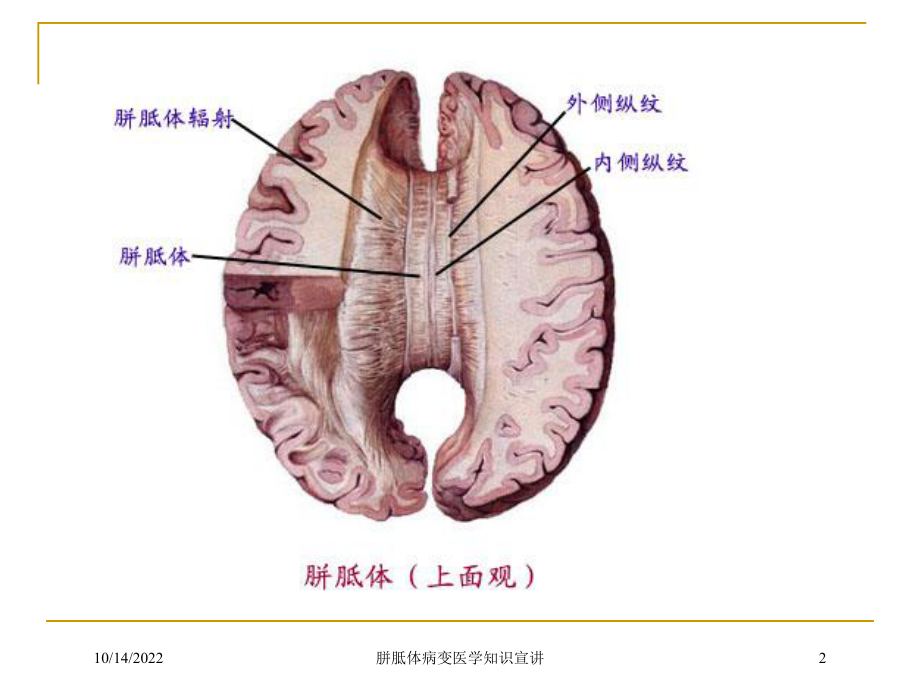 胼胝体病变医学知识宣讲培训课件.ppt_第2页