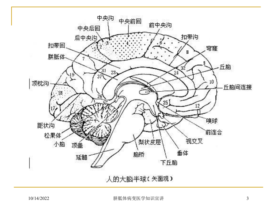 胼胝体病变医学知识宣讲培训课件.ppt_第3页