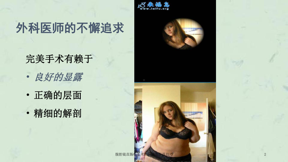 腹腔镜直肠癌手术的扶镜及显露技巧课件.ppt_第2页