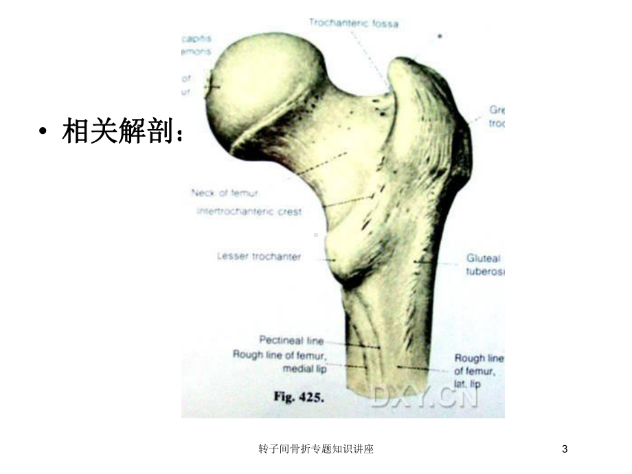 转子间骨折专题知识讲座培训课件.ppt_第3页