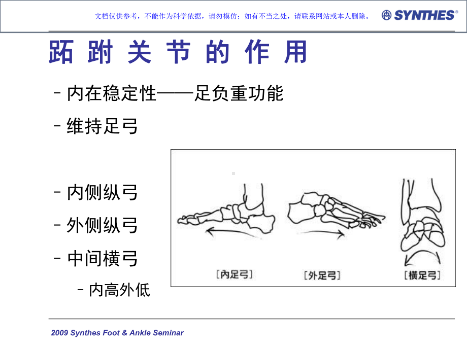 跖跗关节Lisfranc损伤的治疗课件.ppt_第3页