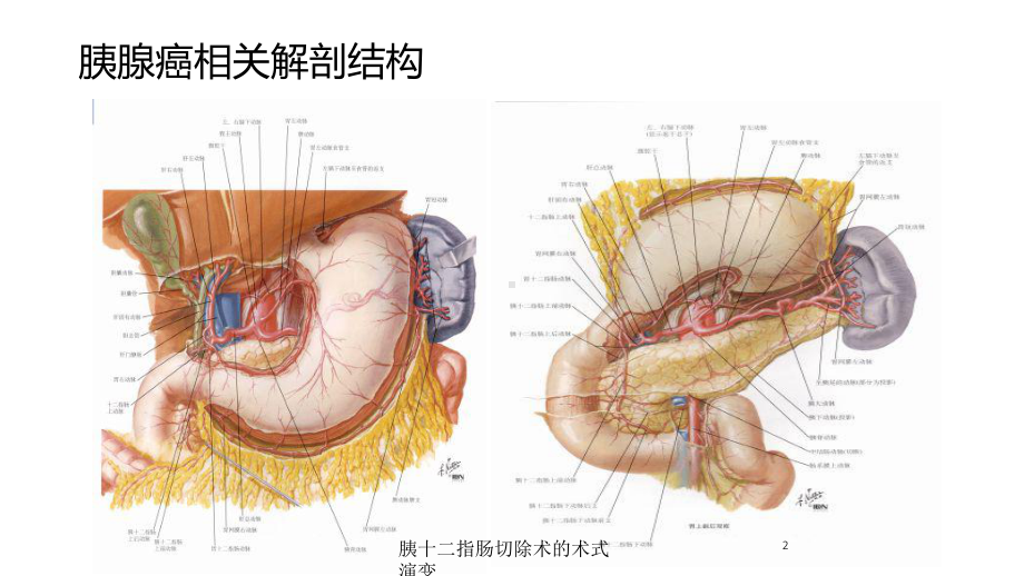 胰十二指肠切除术的术式演变培训课件.ppt_第2页