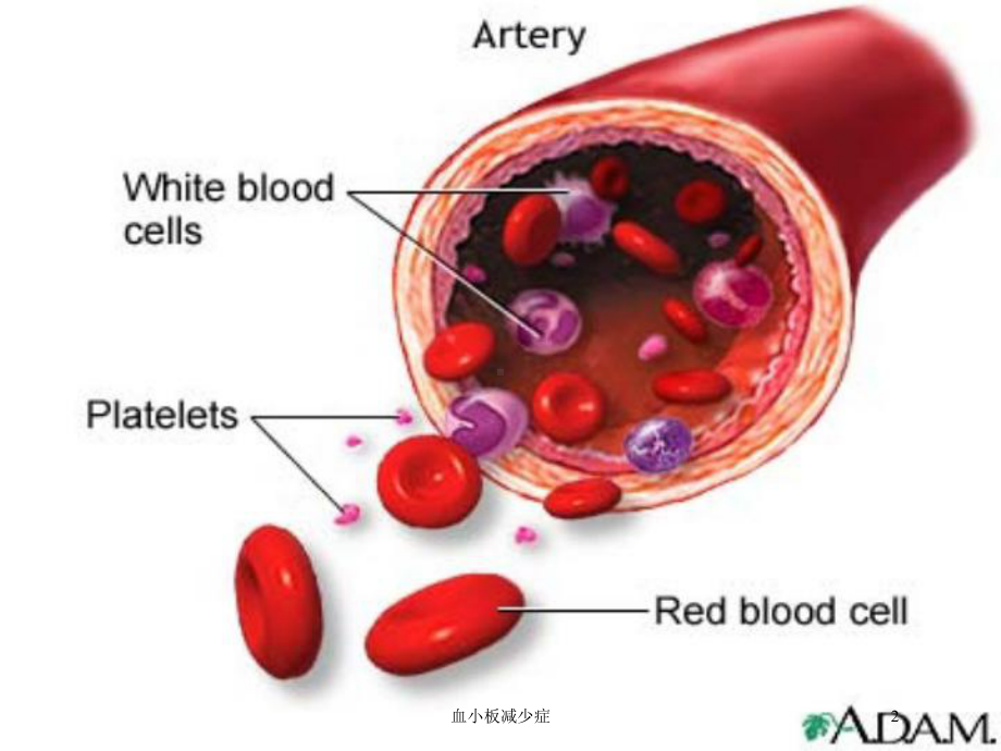 血小板减少症培训课件.ppt_第2页