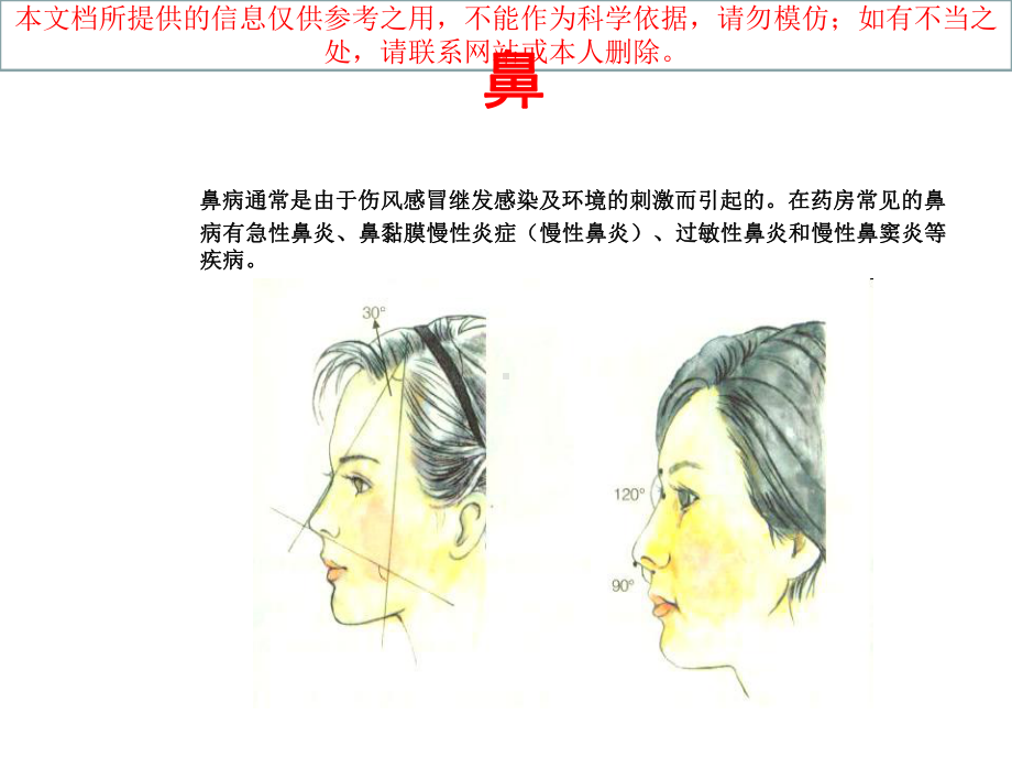 药店常见急性鼻炎用药培训课件.ppt_第2页