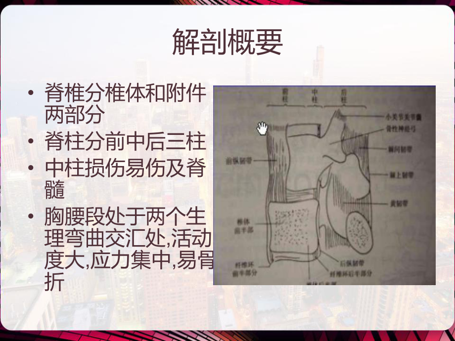 脊椎骨折护理-课件.pptx_第2页