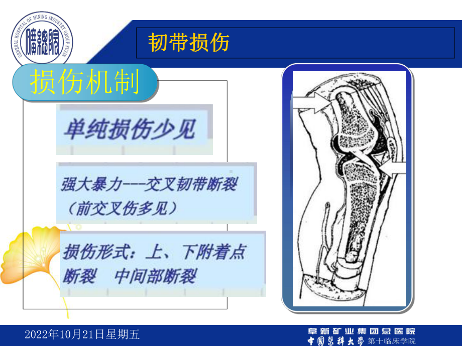 膝关节韧带损伤的MRI诊断课件.ppt_第3页