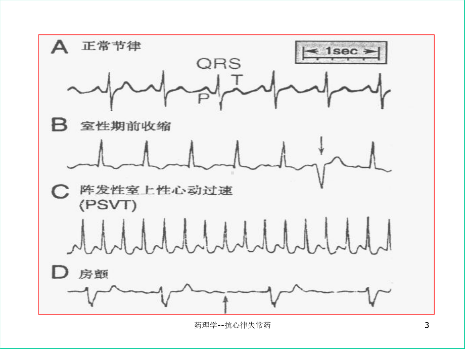 药理学抗心律失常药-课件.ppt_第3页