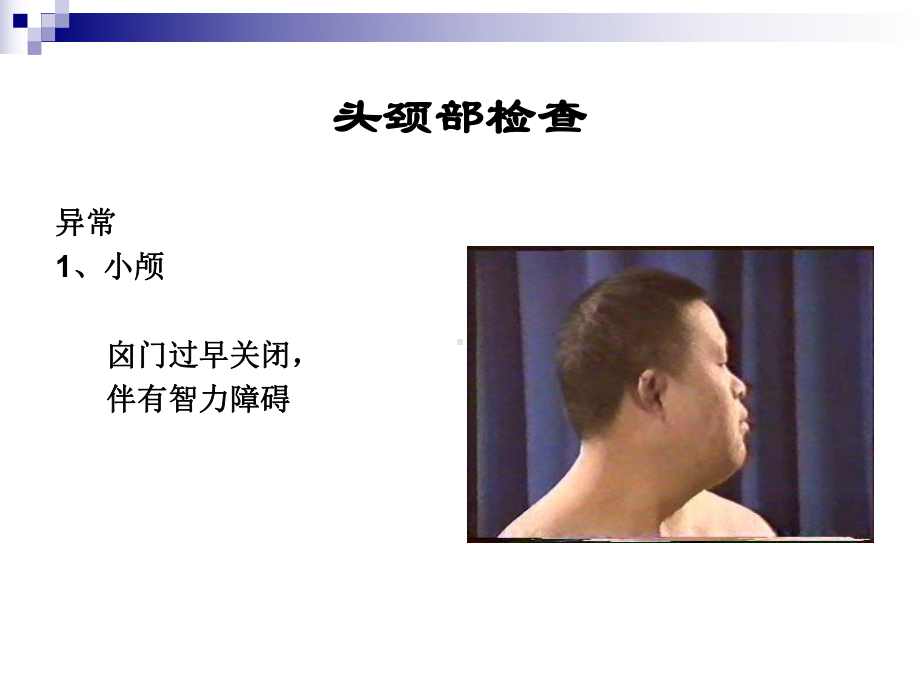 西医诊断学头颈部检查课件.ppt_第3页