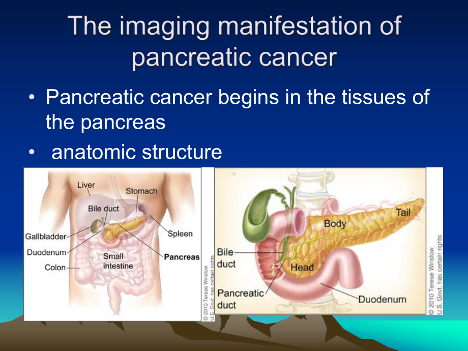 胰腺癌影像学表现英语读片课件.ppt_第1页