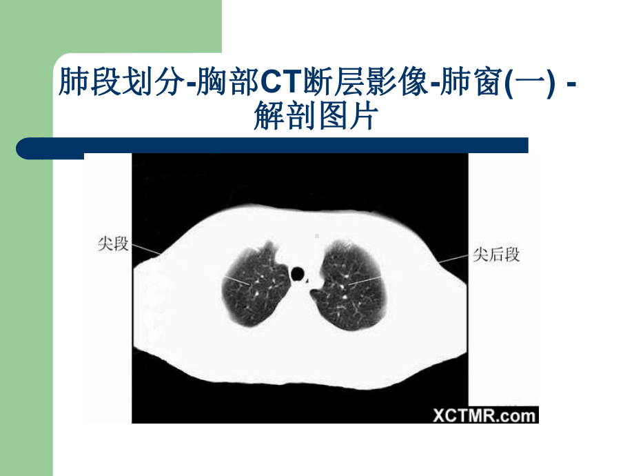 胸腹部CT阅片教材课件.ppt_第3页