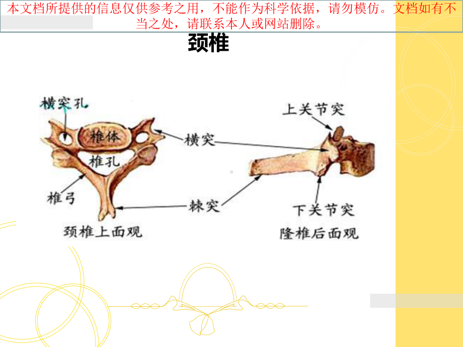 胎儿脊柱异常的超声诊疗培训课件.ppt_第2页