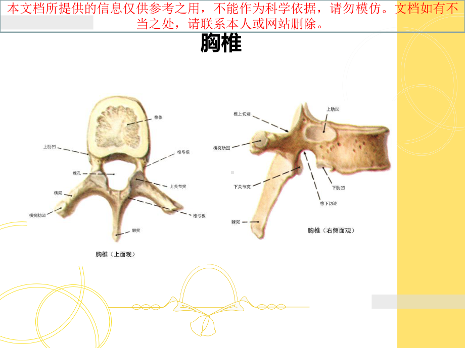 胎儿脊柱异常的超声诊疗培训课件.ppt_第3页