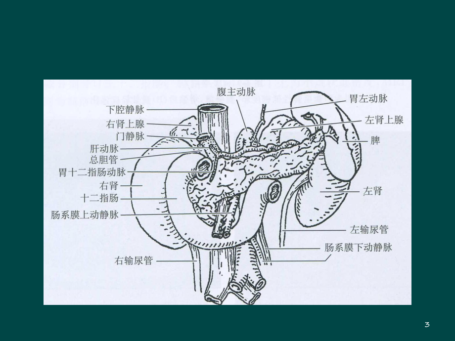 胰腺假性囊肿课件-2.ppt_第3页