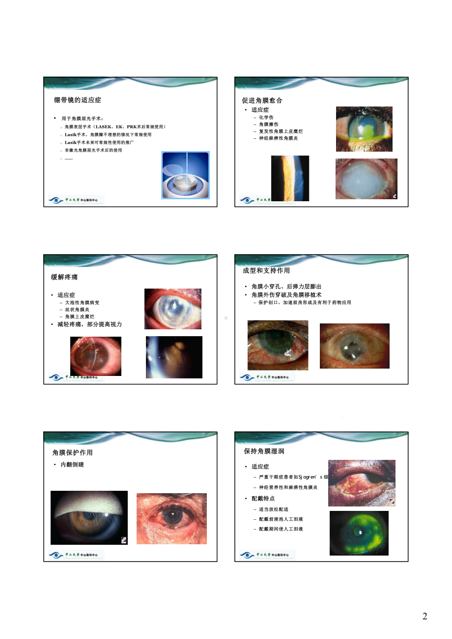 接触镜的眼科临床应用课件.pptx_第2页