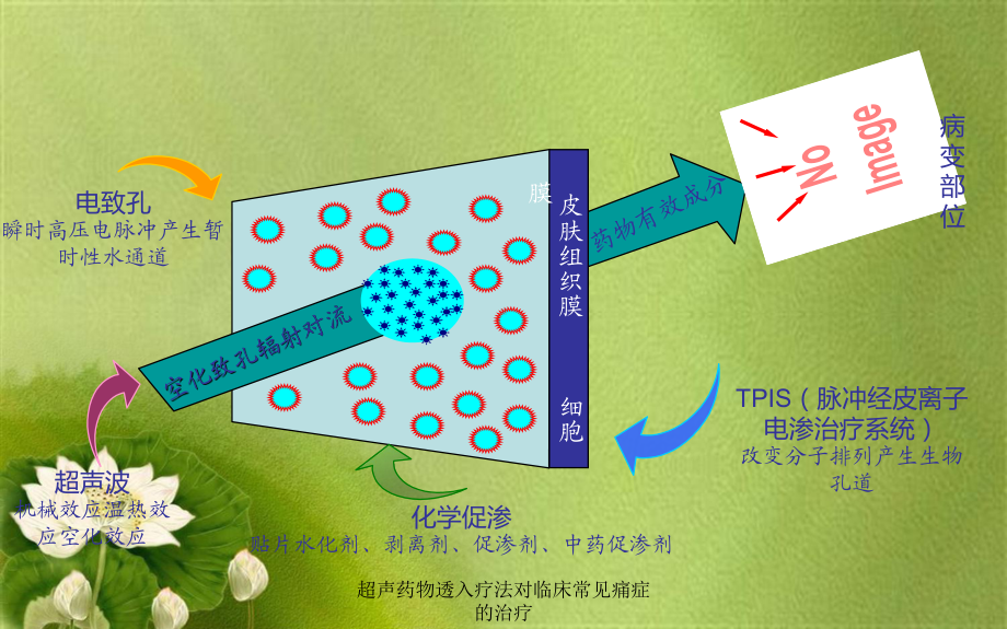 超声药物透入疗法对临床常见痛症的治疗课件.pptx_第3页