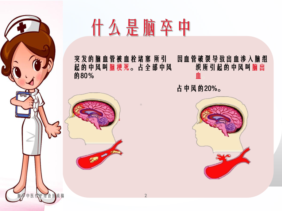 脑卒中医疗护理查房成稿培训课件.ppt_第2页