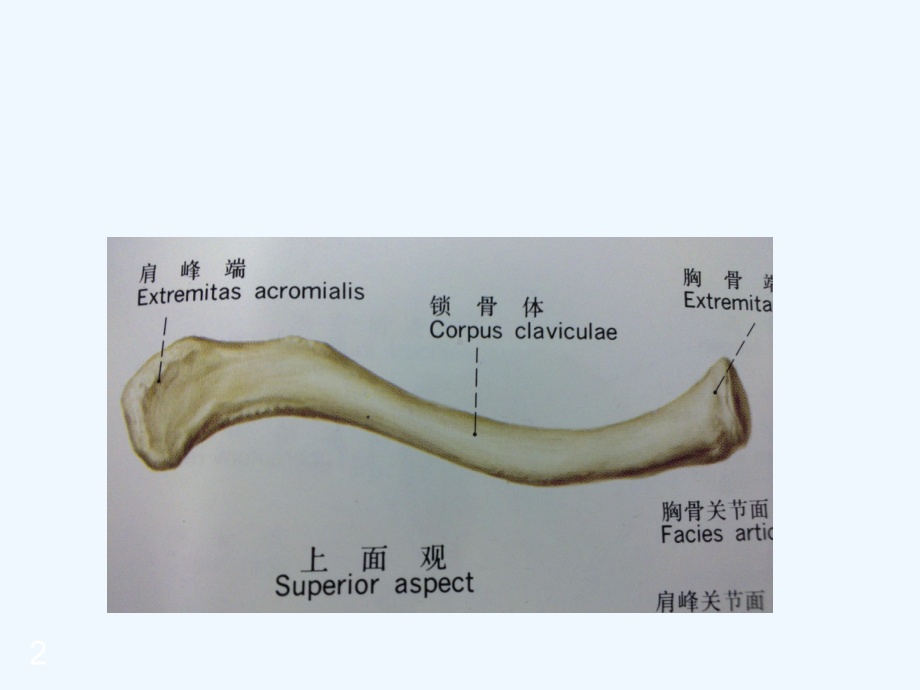 锁骨骨折的治疗-课件.ppt_第2页