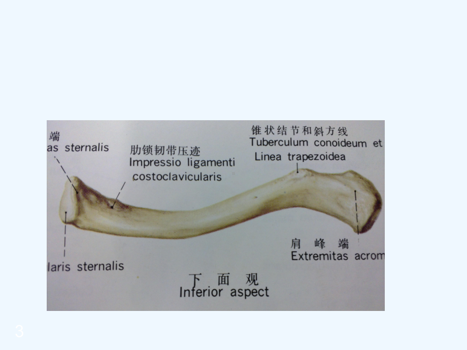 锁骨骨折的治疗-课件.ppt_第3页