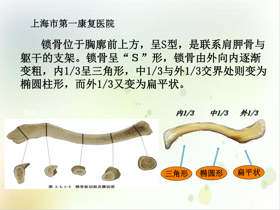 锁骨骨折内固定实用版课件.ppt_第3页