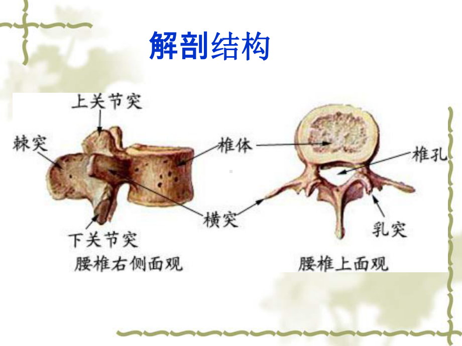 腰腿痛护理查房课件.pptx_第3页