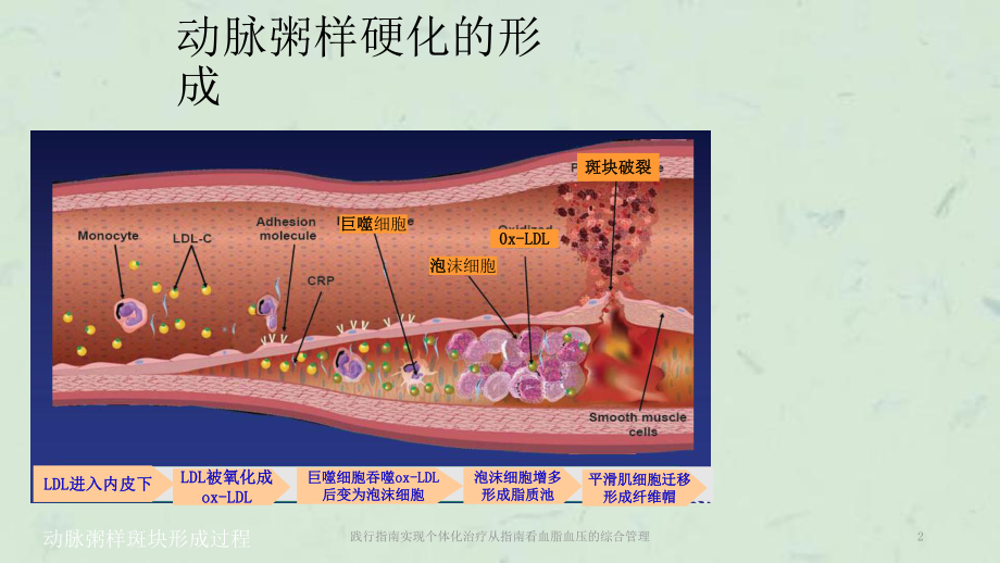 践行指南实现个体化治疗从指南看血脂血压的综合管理课件.pptx_第2页