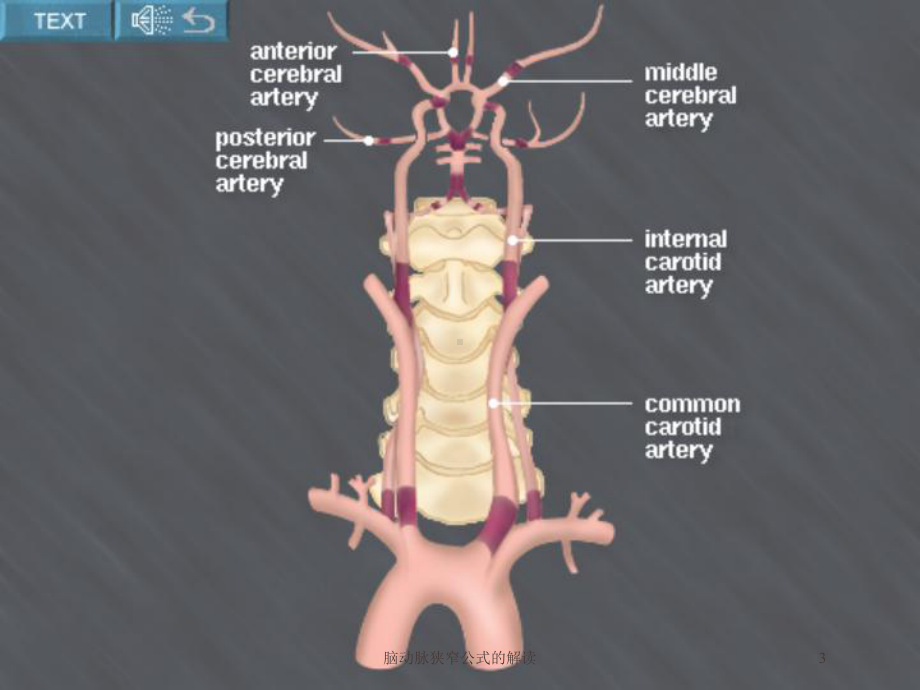 脑动脉狭窄公式的解读培训课件.ppt_第3页
