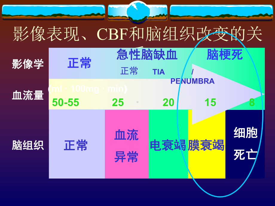 脑血管狭窄的诊疗和治疗讲义课件.ppt_第3页