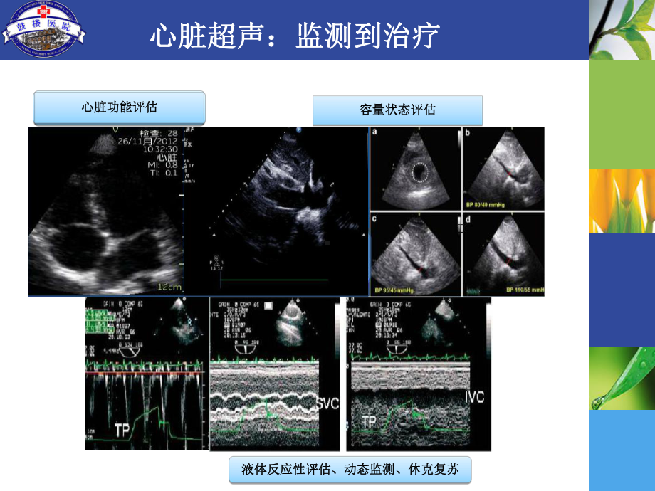 肾脏超声导向的AKI早期诊断课件.ppt_第3页