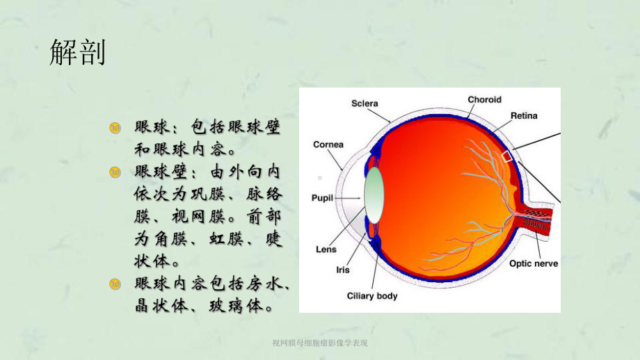 视网膜母细胞瘤影像学表现课件.ppt_第2页