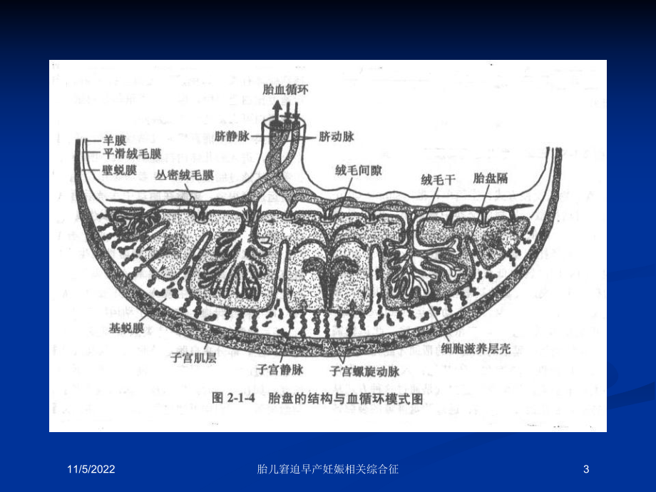 胎儿窘迫早产妊娠相关综合征培训课件.ppt_第3页