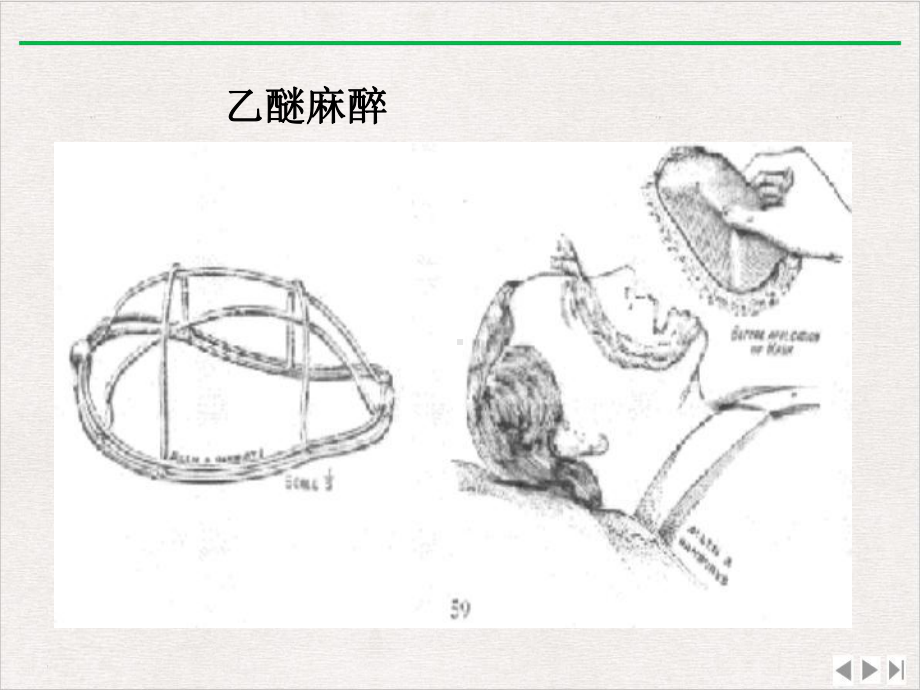 若干临床检验指标在手术麻醉中的危险值某课件.ppt_第3页