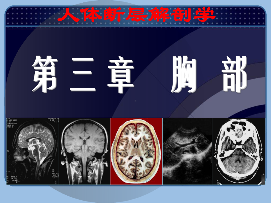 人体断层解剖学-胸部断层解剖-课件.ppt_第2页