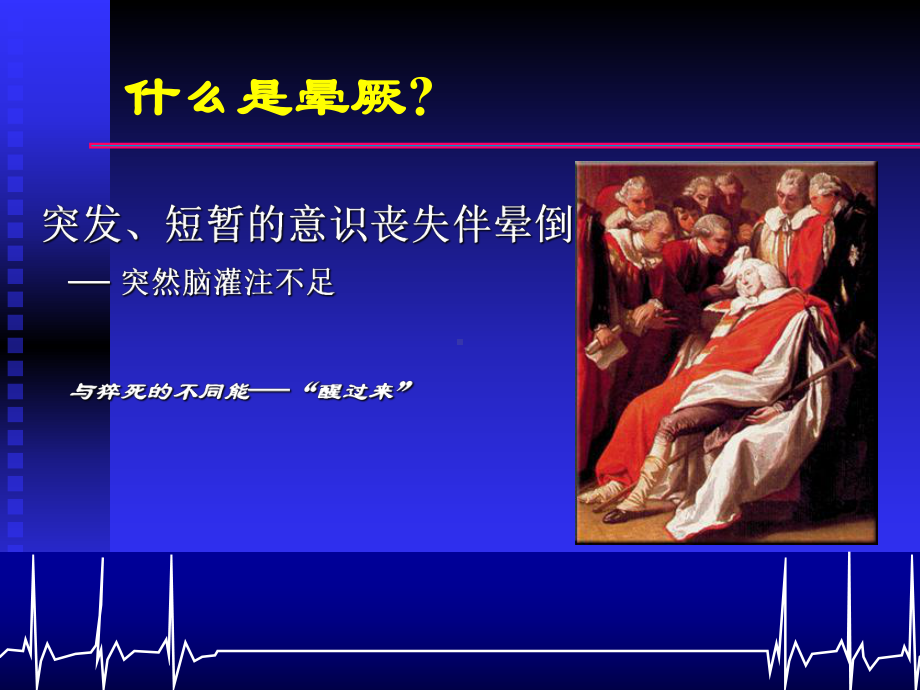 晕厥的鉴别诊断及治疗原则qss课件.ppt_第3页