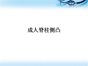 退变性成人脊柱侧凸参考课件.ppt