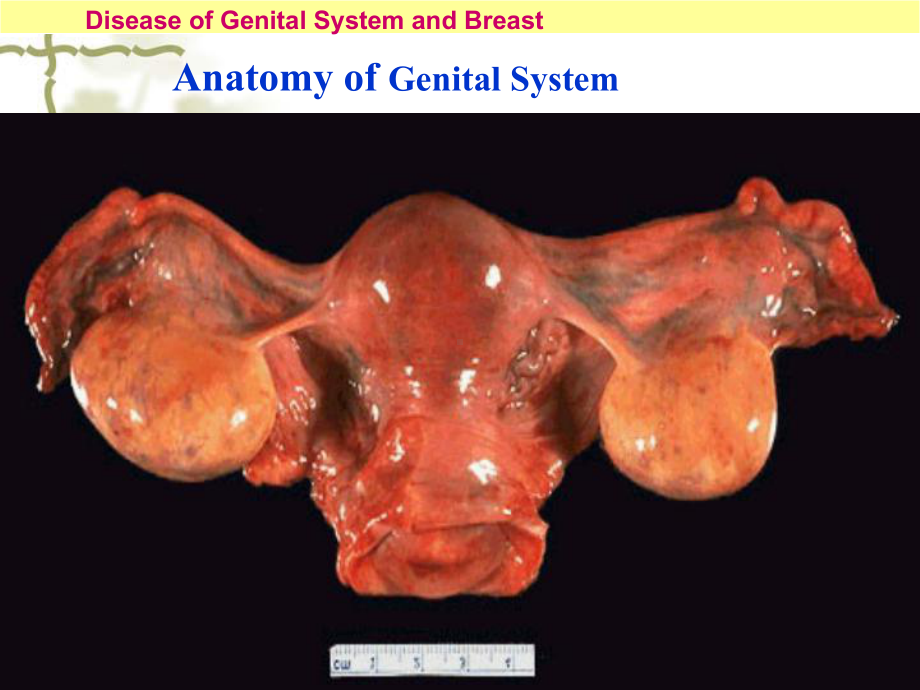 病理学生殖系统疾病课件.ppt_第3页