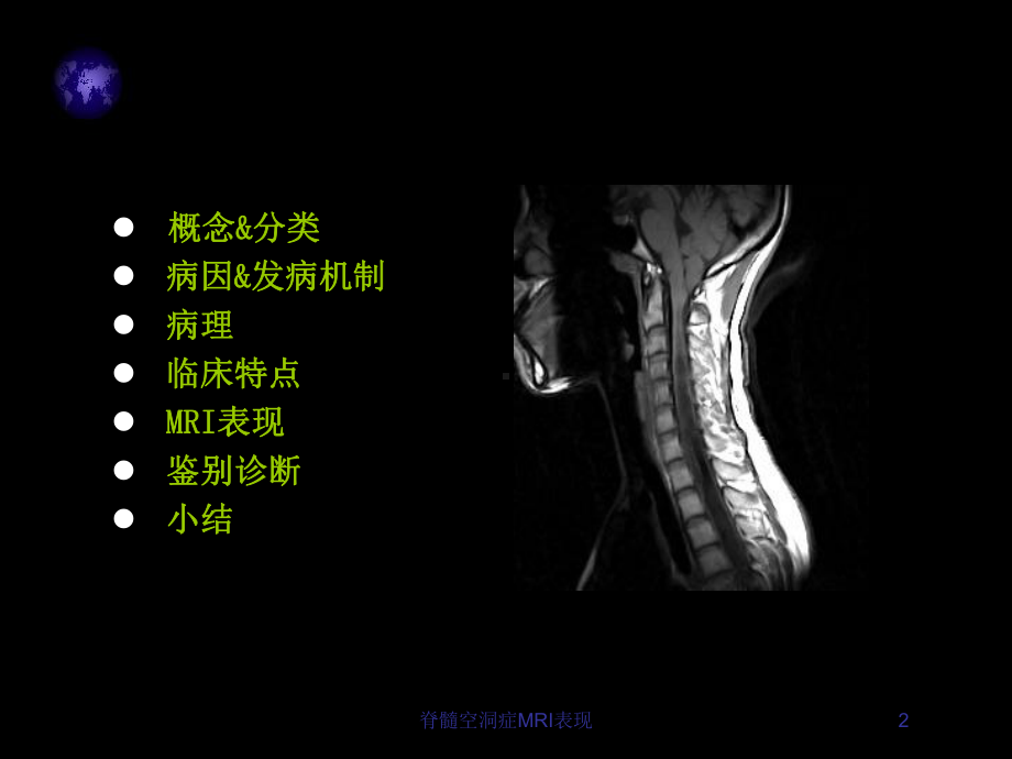 脊髓空洞症MRI表现-培训课件.ppt_第2页