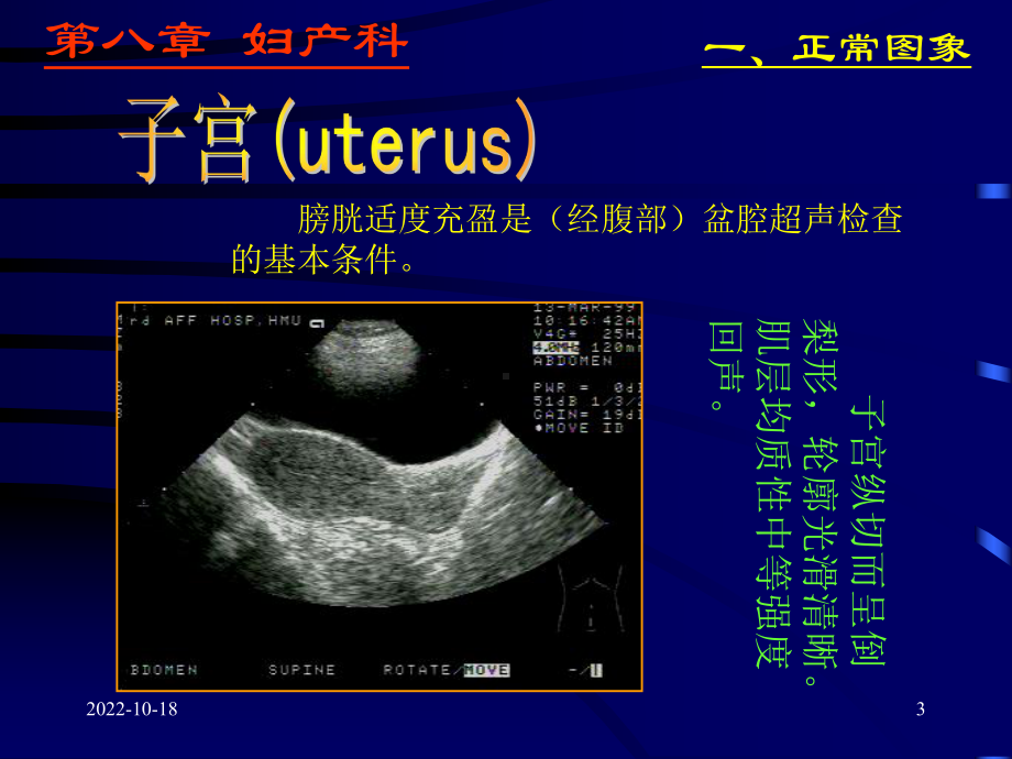 妇产科超声检查-课件.ppt_第3页