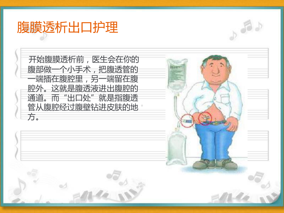 腹膜透析出口护理-课件.ppt_第2页