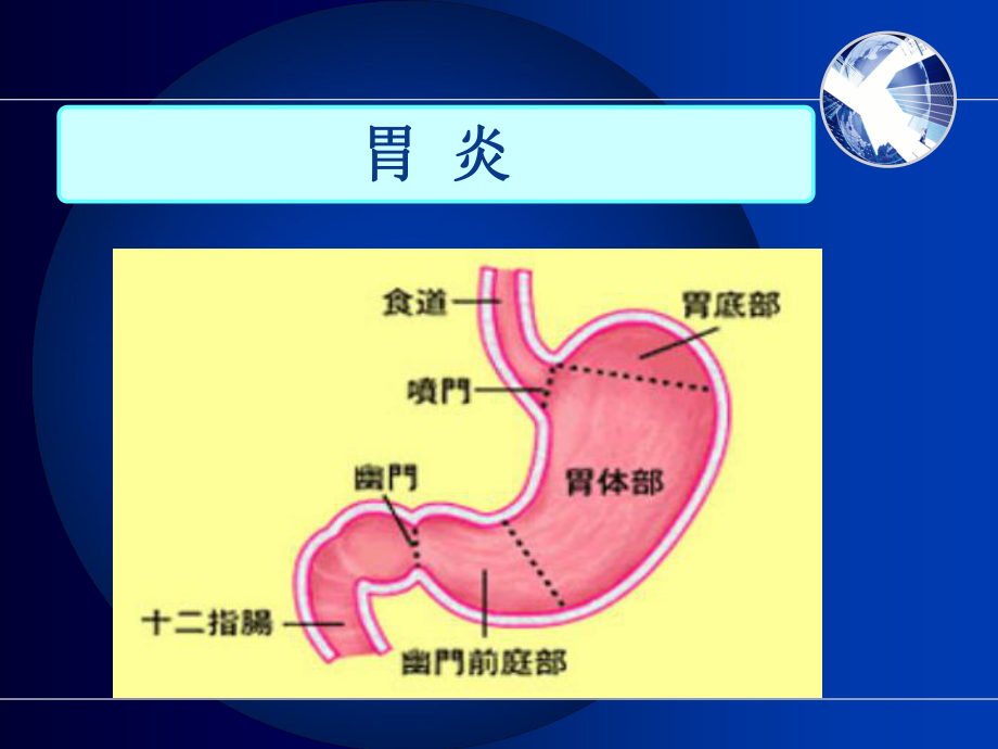 胃炎病人的护理课件-2.ppt_第2页