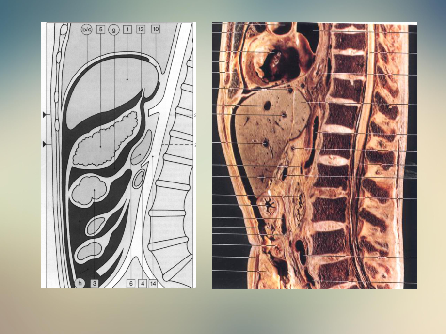 腹膜腔腹膜后CT检查课件.ppt_第3页