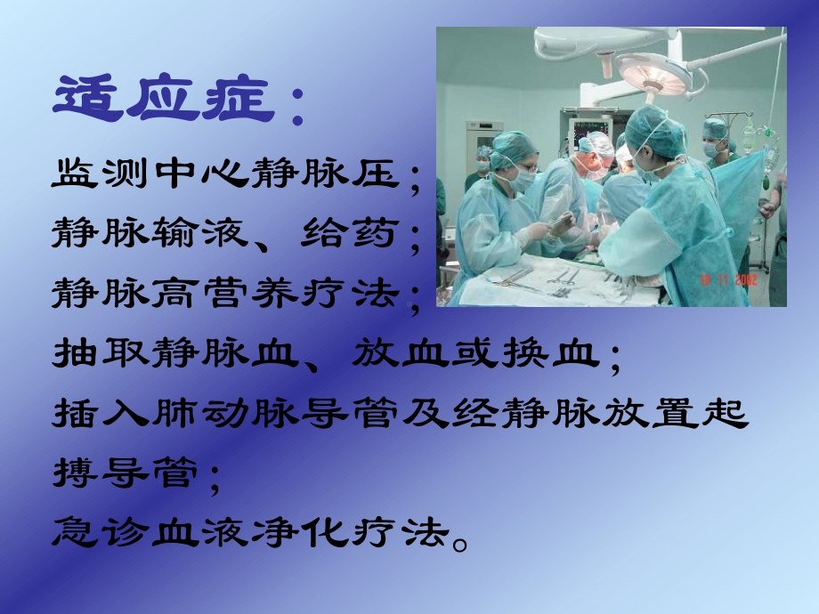 深静脉穿刺置管术讲义课件.ppt_第3页