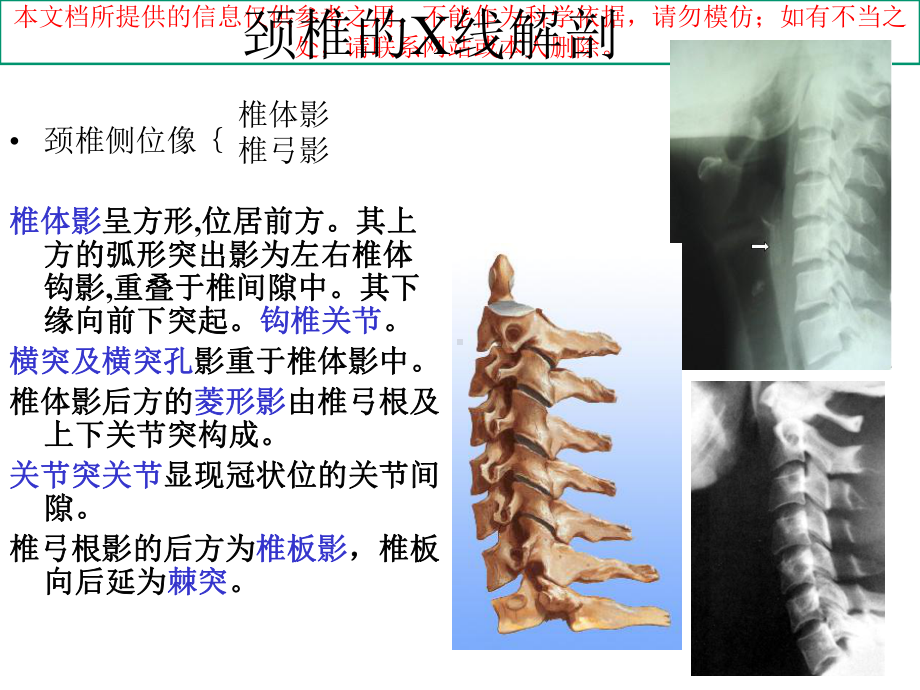 脊柱的X线解剖培训课件.ppt_第1页