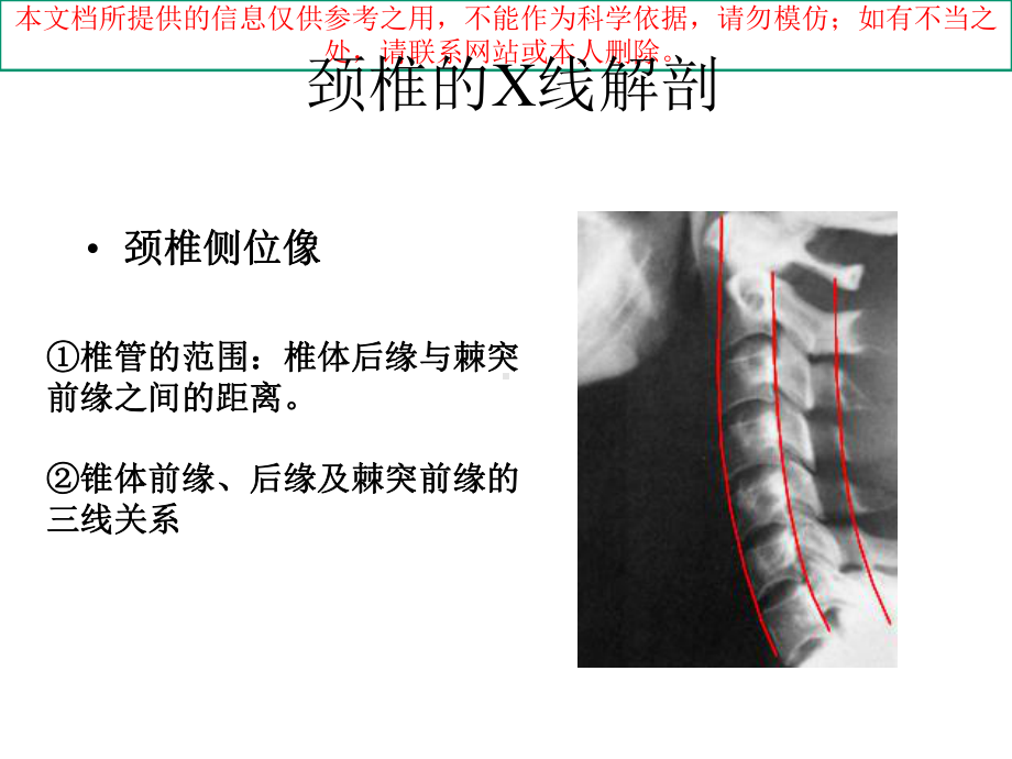 脊柱的X线解剖培训课件.ppt_第2页