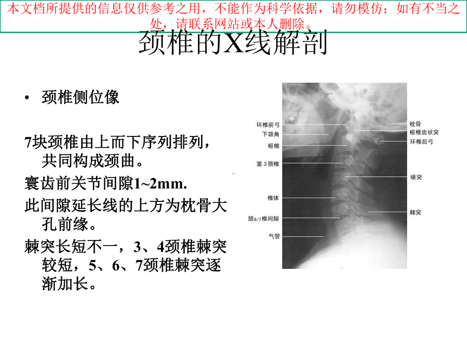 脊柱的X线解剖培训课件.ppt_第3页