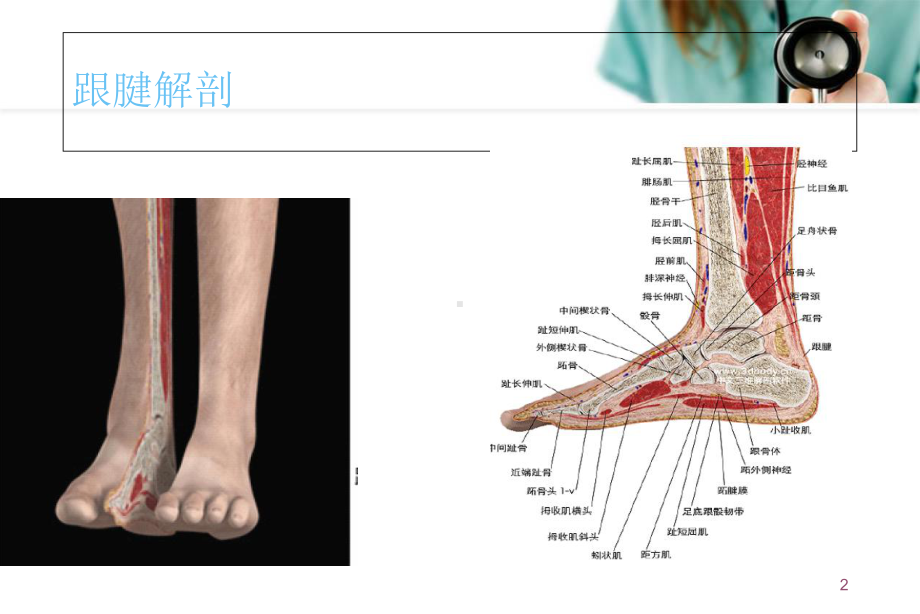 跟腱断裂术后康复流程优质课件.ppt_第2页