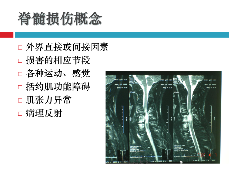 脊髓损伤概述培训课件.ppt_第3页